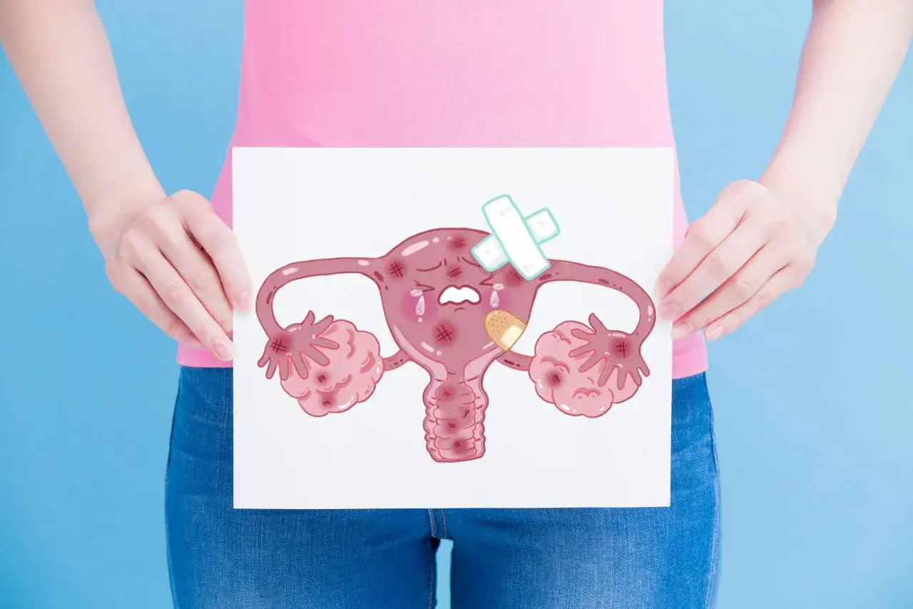 Smutna macica z plastrami, symbolizująca adenomiozę i ból.